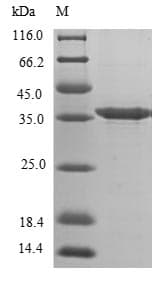 Mouse DCN / Decorin Protein (Recombinant 6His, N-terminus)