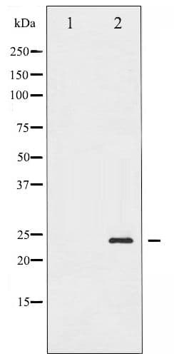BAD Antibody (phospho-Ser155)