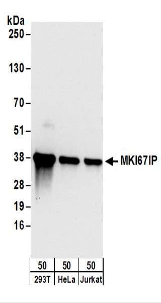 NIFK / MKI67IP Antibody (aa243-293)