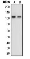 OCRL Antibody (Internal)