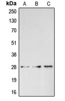 Polyclonal Rabbit anti-Human BRMS1 Antibody (C-Terminus, WB)