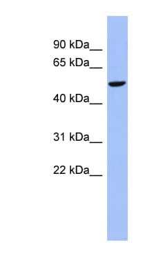 CBLL1 / HAKAI Antibody (N-Terminus)