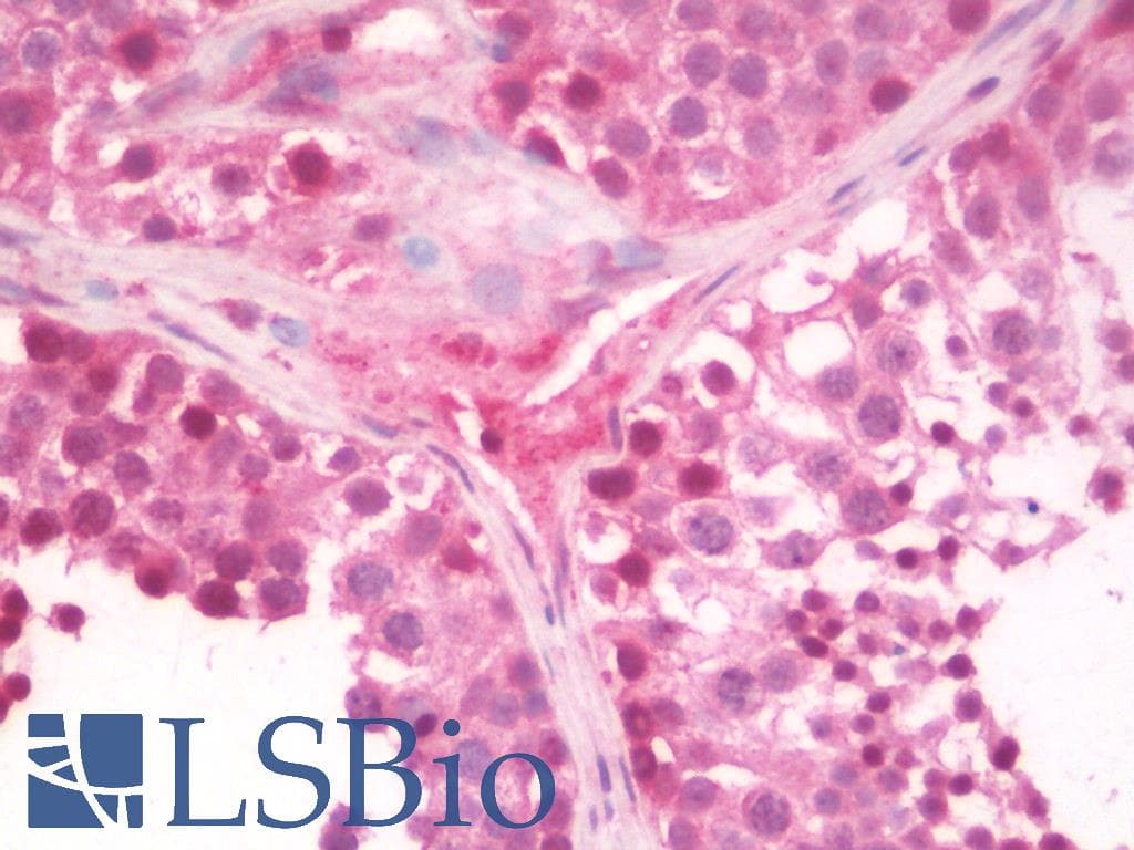 IHC-plus™ Polyclonal Rabbit anti-Human CRTC2 / TORC2 Antibody (IHC, IF, WB)