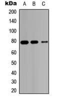 Polyclonal Rabbit anti-Human HSD17B4 Antibody (Internal, WB)