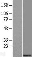 MRPS21 Protein (Over-Expression Lysate Myc-DDK (Flag))