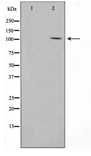 Polyclonal Rabbit anti-Human PSMD2 Antibody (WB)