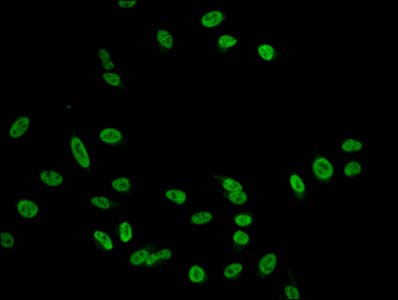 Polyclonal Rabbit anti-Human HIST1H2AI Antibody (IHC, IF)
