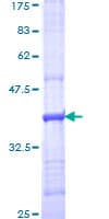 Human Complement C5 Protein (Recombinant GST, N-terminus)