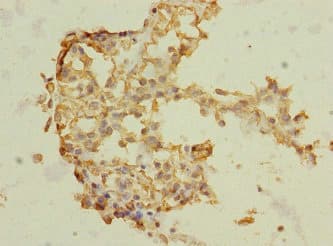 TRHDE Antibody