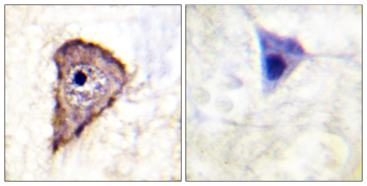 FLT1 / VEGFR1 Antibody (phospho-Tyr1333)