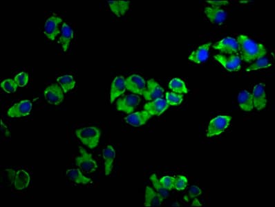 ADCY5 / Adenylate Cyclase 5 Antibody
