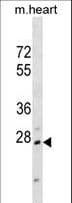 HOXB1 Antibody (aa19-46)