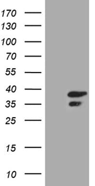 CLTA / LCA Antibody (clone OTI2F7)