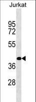 RBMS2 / SCR3 Antibody (aa1-30)