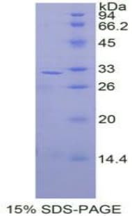 Human MAP2K3 / MEK3 / MKK3 Protein (Recombinant His-T7)