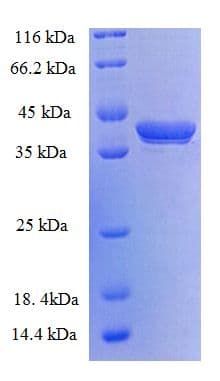 Human GAGE5 Protein (Recombinant GST)