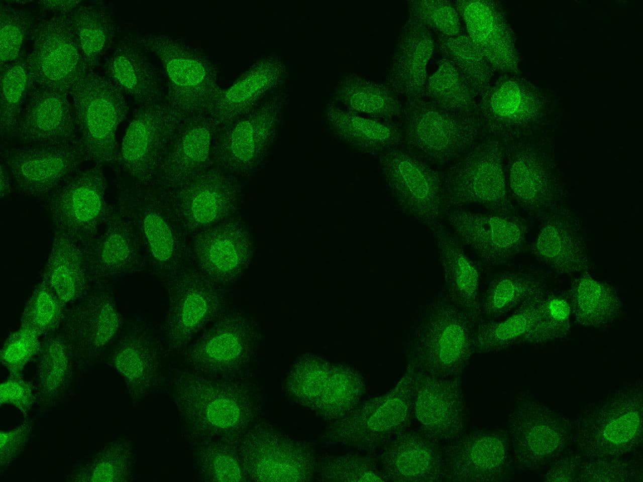 NUP62 Antibody