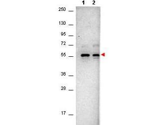 AKT1 Antibody (Internal, clone 14E5.16C8.25F6)