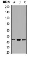 BCAT1 / ECA39 Antibody (Internal)