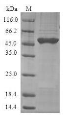 Human GLO1 / Glyoxalase I Protein (Recombinant GST, N-terminus)