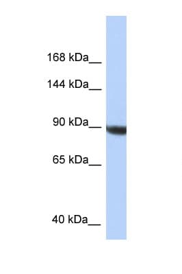 KIAA1549 Antibody (C-Terminus)