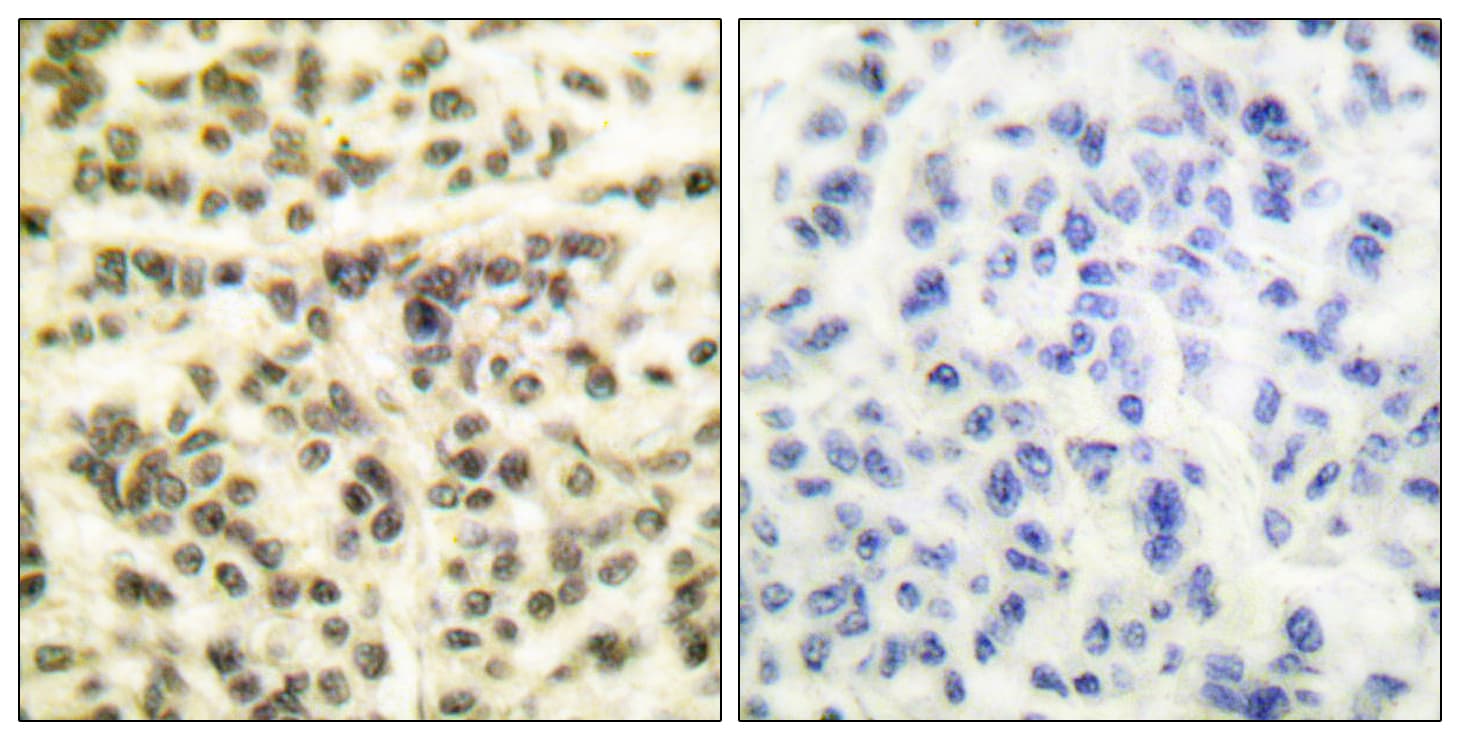 MAPKAPK2 / MAPKAP Kinase 2 Antibody (aa300-349)