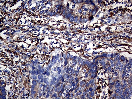 TGM2 / Transglutaminase 2 Antibody (clone OTI4H5, Carrier-free)