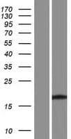 TBC1D29 Protein (Over-Expression Lysate Myc-DDK (Flag))