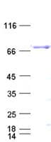 Human BTK Protein (Recombinant His,C-terminus)