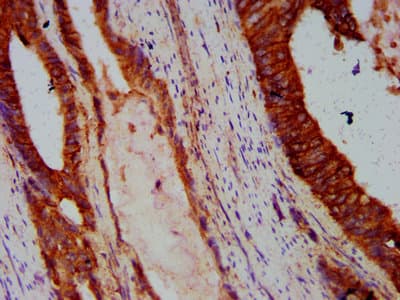 IHC-plus™ Polyclonal Rabbit anti-Human CDH1 / E Cadherin Antibody (IHC, IF, WB)