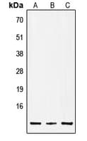 Polyclonal Rabbit anti-Human Insulin Antibody (Internal, WB)