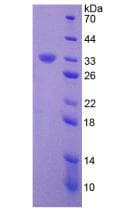 Human ER Alpha / Estrogen Receptor Protein (Recombinant His, N-Terminal)