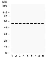 MAOB / Monoamine Oxidase B Antibody