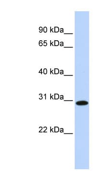 SMNDC1 Antibody (C-Terminus)