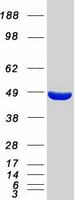 Human Mannose Phosphate Isomerase Protein (Recombinant Myc-DDK (Flag))