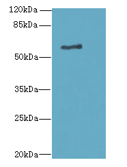 ALAS2 Antibody