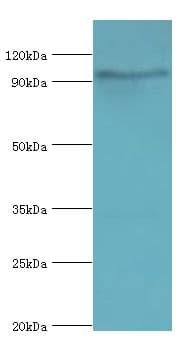 Polyclonal Rabbit anti-Human MCPH1 Antibody (aa536-835, IHC, WB)