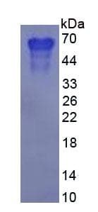 Human SPP1 / Osteopontin Protein (Recombinant His, N-Terminal)
