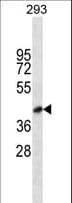 BVES Antibody (aa313-342)