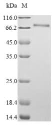 Human MLF1 Protein (Recombinant GST, N-terminus)