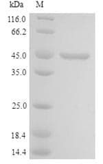 Human LYAR Protein (Recombinant 6His, N-terminus)