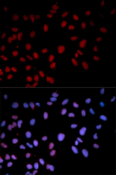 MAPK14 / p38 Antibody (phospho-Thr180)