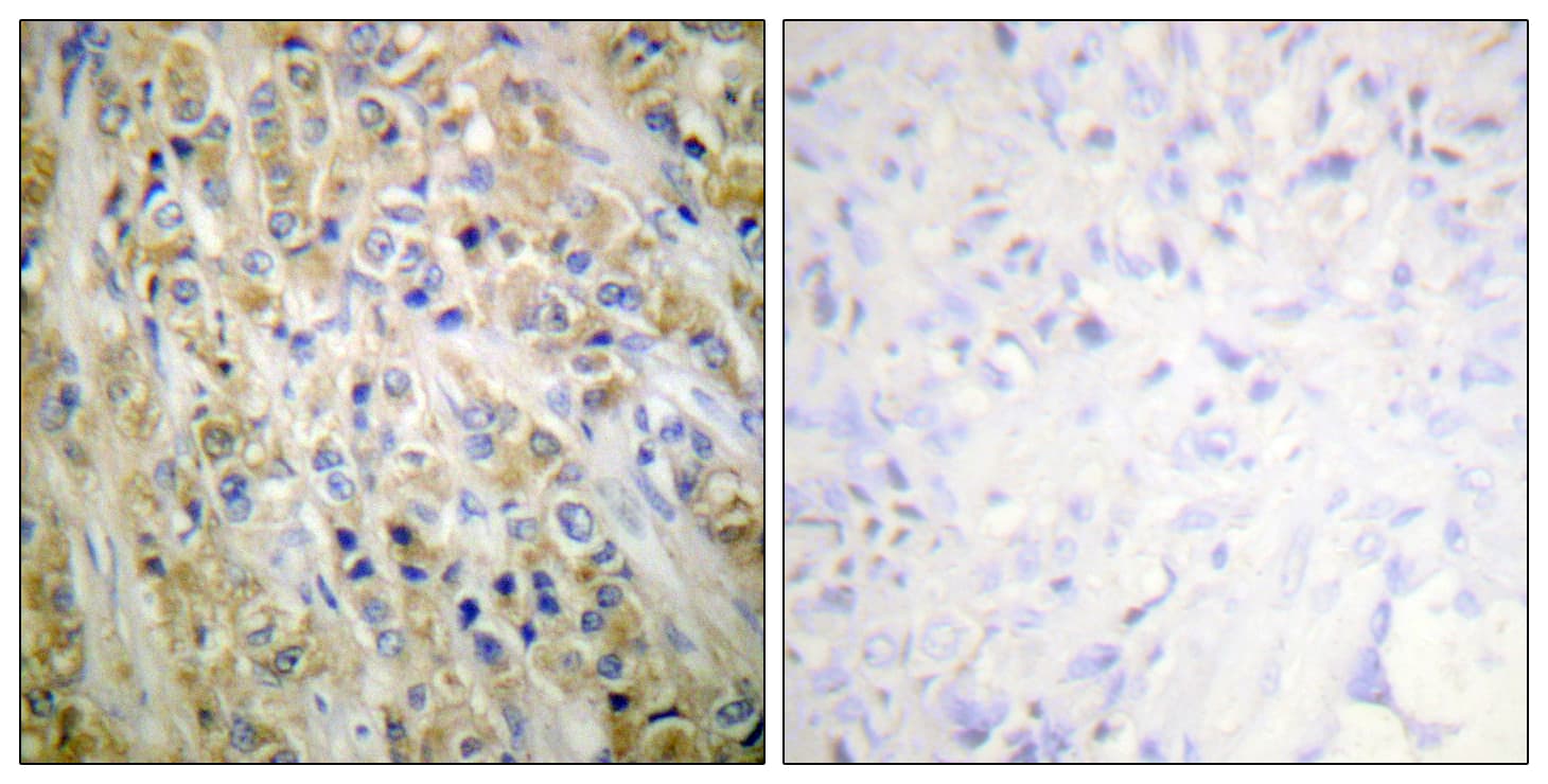 KLK3 / PSA Antibody (aa81-130)