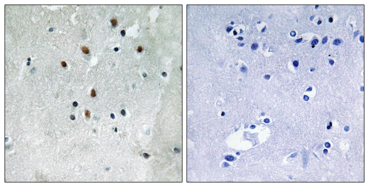 SRF / Serum Response Factor Antibody (phospho-Ser77)