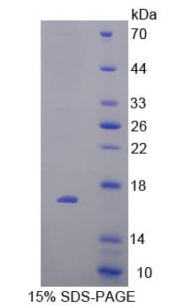 Bovine P450SCC / CYP11A1 Protein (Recombinant His-T7)