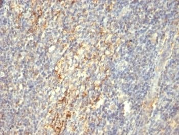 TGM2 / Transglutaminase 2 Antibody (clone SPM592)