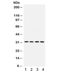 LOX / Lysyl Oxidase Antibody