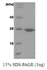 Human PARK7 / DJ-1 Protein (Recombinant His)