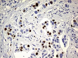 Monoclonal Mouse anti-Human MKI67 / Ki67 Antibody (clone OTI5D7, IHC)