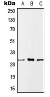 Polyclonal Rabbit anti-Human MLF1 Antibody (Internal, WB)